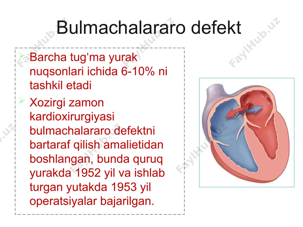 orkada kolish ko‘krak kafasini deformatsiyasi tush suyagining chap tomonida iii-iv kovurgalar aro soxasida sistolik shovkini nukson soxasiga yamok tikilgan korinchalar aro devorning nuksoni yurak devori nuksonini yopish uchun transkateter sistemali (amplatzer) okklyuder fallo tetradasi o‘pka arteriyasini torayishi, korinchalar aro tusik nuksoni, aortani o‘ng tomonga siljishi va uni korinchalar aro tusik nuksonini ustida joylashishi o‘ng korincha devorining gipertrofiyasi fallo tetradasi fallo tetradasi umrovosti- upka anastomozi (blelok-tausig amaliyoti fallo tetradasida korinchalar aro tusik nuksoniga yamok tikish aorta koarktatsiyasi bosh ogrishi arterial kon bosimining oshishi burindan kon ketishi yurak soxasidagi ogriklar yurak urishi boshda ogirlikni va pulsatsiyanni sezish aorta koarktatsiyasi