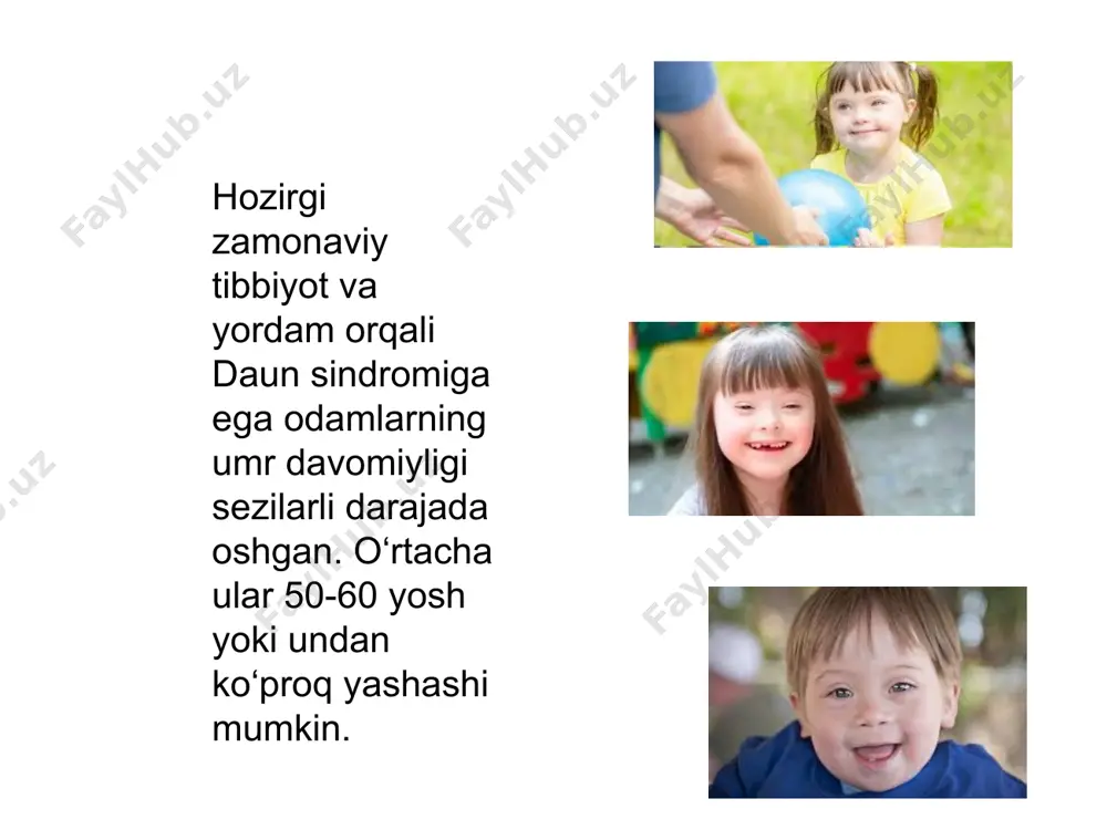 daun sindromi - Page 4