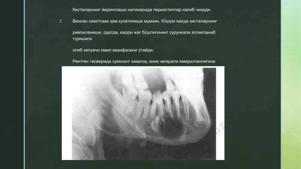 odontogen o‘smasimon hosilalar. - Page 5