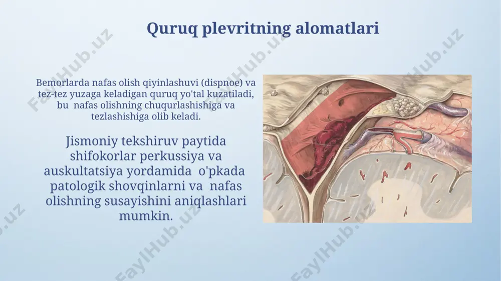 oʻpka absessi, quruq va ekssudativ plevretlar - Page 5