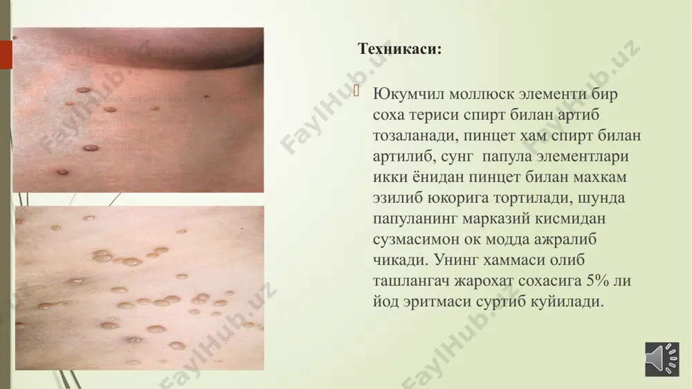 molliusk tanachasini sikiib chikarish amaliy kuni - Page 3