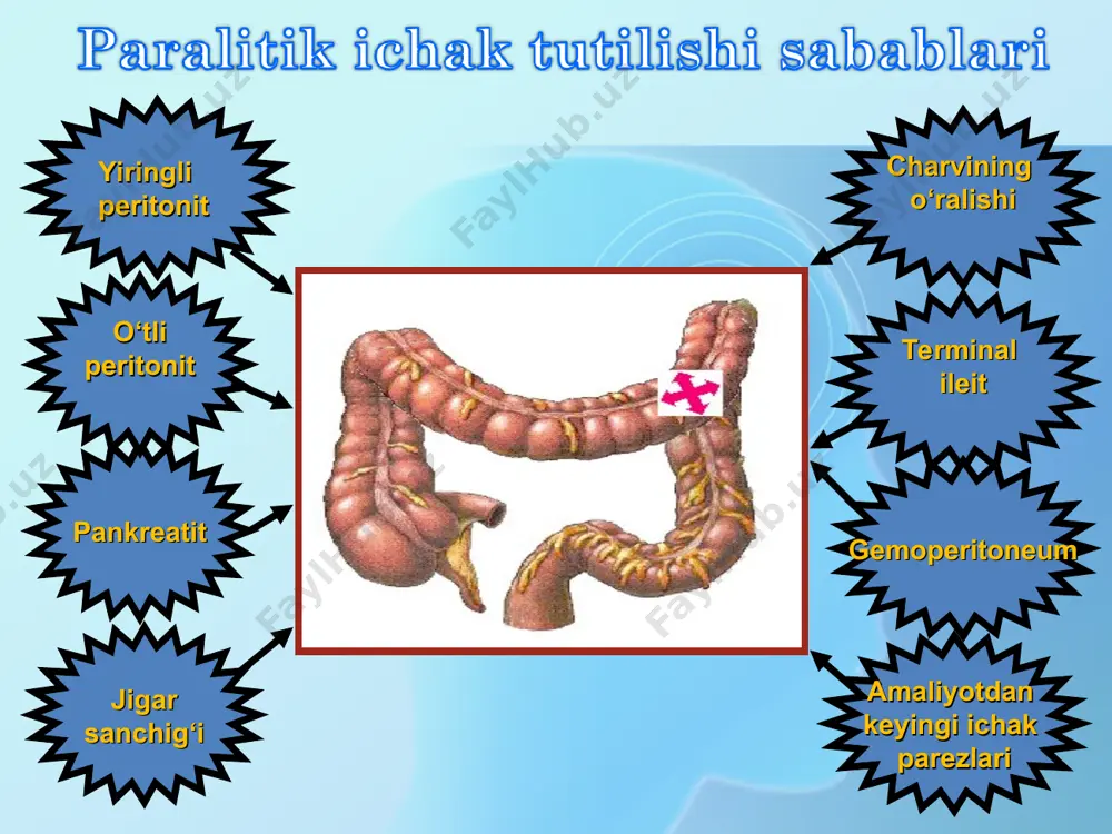 ekvat sanatsiyasi noadekvat drenajlash rivojlanayotgan abssesslarni yorilishi ichak oqmalari letalis doimiy ichak parezi gomeostaz buzilishlari infeksion- toksik shok bemoring sillasi qurishi intoksikatsiya peritonit belgilarini kuchayishi nospetsifik asoratlarda o‘lim sabalari miokard infarkti o‘pka shishi kardiogen shok o‘yuqye o‘ne dvs sindrom gipostatik pnevmoniya ekssudativ plevrit o‘jbe sepsis oligouriya, anuriya диаграмма1 erkaklar erkaklar erkaklar ayollar ayollar ayollar 0.8 0.2 sheet1 erkaklar ayollar 80% 20%