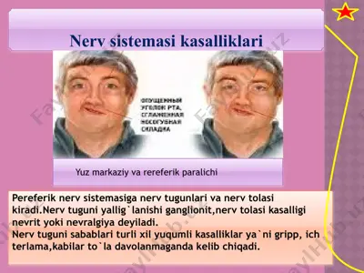nerv sistemasi kasalliklari — PPTX