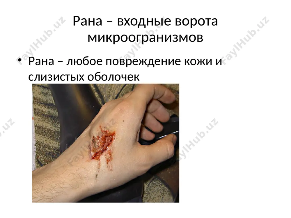 профилактика хирургической инфекции - Page 4