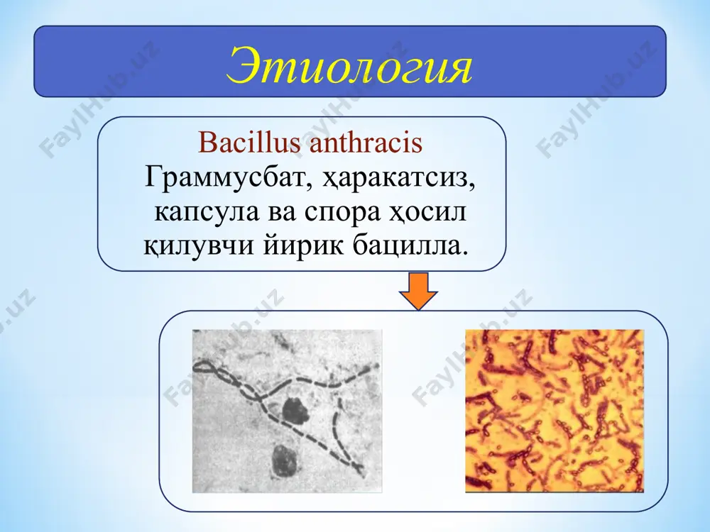 льтратив асоси бор, яра атрофи қизил ҳошияси мавжуд); атрофдаги юмшоқ тўқимларнинг шиши (желесимон), оҳиста уриб кўрилганда лиқиллайди (стефанский белгиси) куйдиргининг ўпка шакли: инкубацион давр 1-6 кун эрта белгилари: иситма, қақшаш; ҳолсизлик, карахтлик; қуруқ йўтал; кўнгил айнаши, қусиш; ҳансираш кучли терлаш; плеврал оғриқ терминал белгилар: иситмани кескин кўтарилиши; тахикардия; кучли терлаш; кўкрак қафаси/бўйин териости клетчаткасининг шиши; респиратор дистресс; шок; ўлим (бир неча соат/кун ичида) клиниканинг қисқа вақт давом этиши куйдиргининг ўпка шакли (шубҳали ҳолатлар): ўткир оғир ҳолат, қуйидаги белгилардан бирортаси билан: баланд иситма; мушакларда оғриқ; инфекцион-токсик шок; двс синдром; куйдиргининг ўпка шакли (шубҳали ҳолатлар): маҳаллий ўзгаришлар: тез оғир геморрагик пневмониянинг ривожланиши, кучли нафас етишмовчилиги белгилари; ўпка шиши; кўкрак қафасида оғриқ (плеврит оғриғи); ўпка рентгенографиясида инфилтратлар; плеврал суюқлик йиғилиши; қонли балғам. куйдиргининг ўпка шакли (шубҳали ҳолатлар): регионал белгилар: медиастинал лимфа тугунларининг катталашиши (рентгенограммада кўкс оралиғининг катталашиши); бўйин/кўкрак қафаси тери ости клетчаткасининг шиши. куйдиргининг ўпка шакли: кўкс оралиғининг катталашган (медиастинал лимфа тугунларининг катталашган …