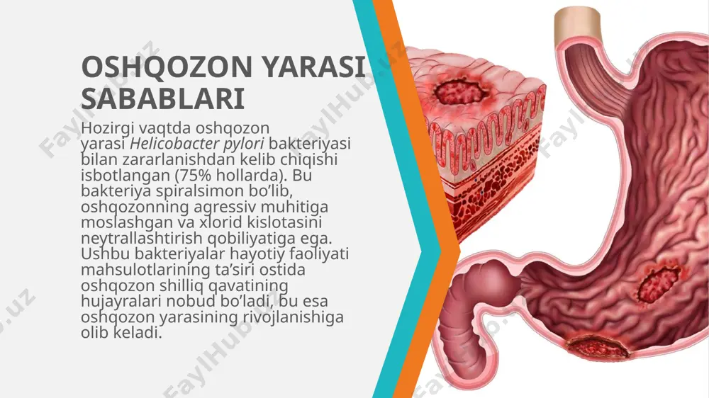 oshqozonning yara kasalligi etiopatogenezi - Page 4
