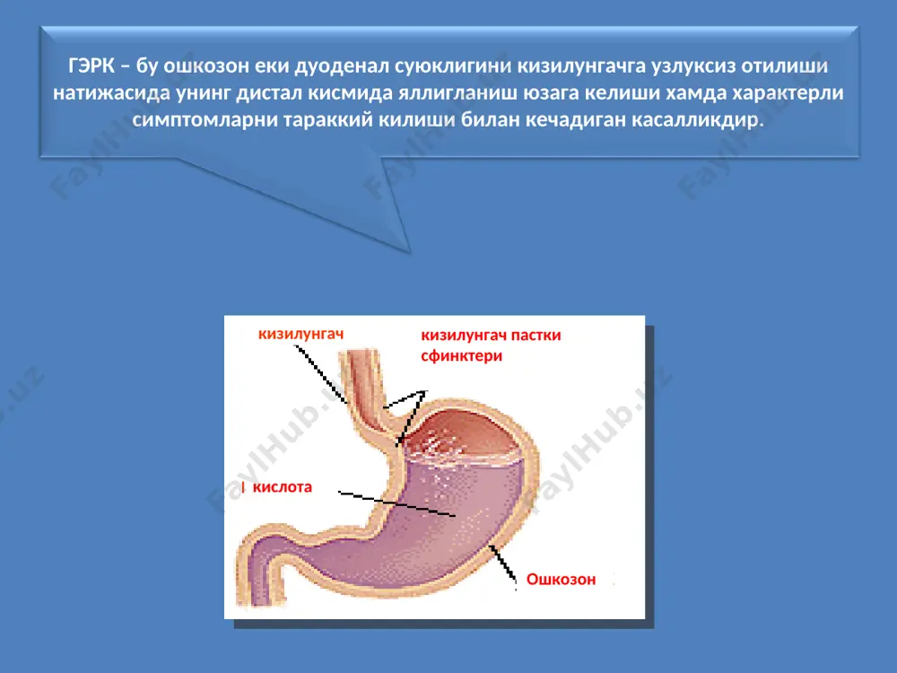 .и.як nh₂ conh ₂ co₂ + nh₃ уреаза нр инфекциясининг ульцероген (гипотеза) таъсири аммиакнинг эркин молекулари ошкозон нр мухитини ишкорий томонга суради ва гастрин гиперпродукциясига олиб келади. натижада нсl хосил булиши ошади хамда агрессив ва химоя омиллари орасидаги динамик баланс агрресив омиллар фойдасига бузилади. нр голландиялик машхур олим – гастроэнтеролог g. tytgat 1995й.да айни пайт учун диккатга сазовор куйидаги шиорни орага ташлади: «нр инфекцияси булмаса нр билан уйгунлашган як хам булмас эди». нр ва някд дорилар туфайли содир буладиган яралар як ни 95% дан ортигини ташкил килади. ульцерогенезнинг машхур теориялари № теория номи йил муаллиф 1 яллигланиш, «гастритик» 1817 – 1923 ф. уден - g.e. konjetzny 2 инфекцион 1851-1888-1907 labert - м. letull - e. payr 3 васкуляр 1852 r. virchov 4 пептик 1856-1878 с. bernard - н. quincke 5 травматик 1912 l. aschoff 6 нейрорефлектор 1912 rossle 7 нейровегетатив 1913 g. bergmann, 8 нейротрофик 1935 а.д. сперанский 9 кортико-висцерал …