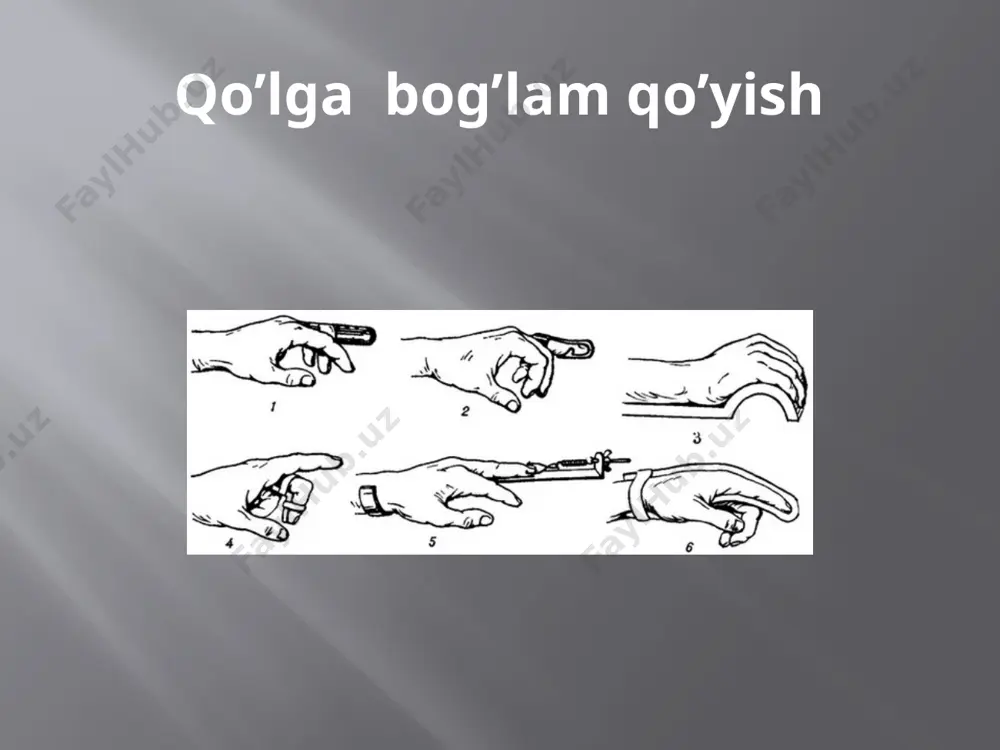 desmurgiya va transport immobilizatsiyasi - Page 4
