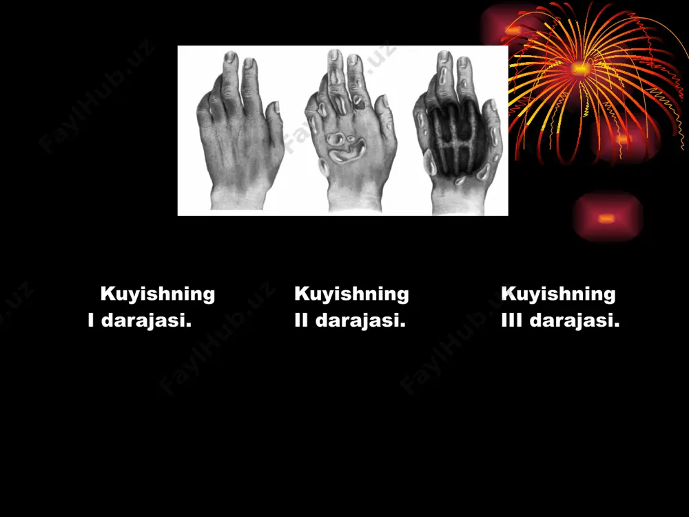 kuyish darajalari - Page 5