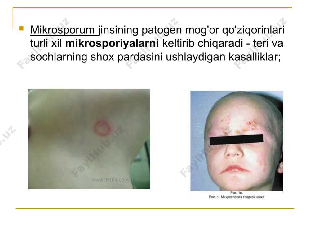patogen zamburug'lar qo'zg'atuvchi kasalliklari - Page 5