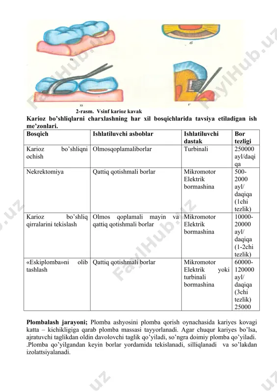 chasida kariyes kovagi katta – kichikligiga qarab plomba massasi tayyorlanadi. agar chuqur kariyes bo’lsa, ajratuvchi taglikdan oldin davolovchi taglik qo’yiladi, so’ngra doimiy plomba qo’yiladi. .plomba qo’yilgandan keyin borlar yordamida tekislanadi, silliqlanadi va so’lakdan izolattsiyalanadi. image2.png image1.png