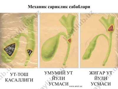 механик сариклик сабаблари — PPT
