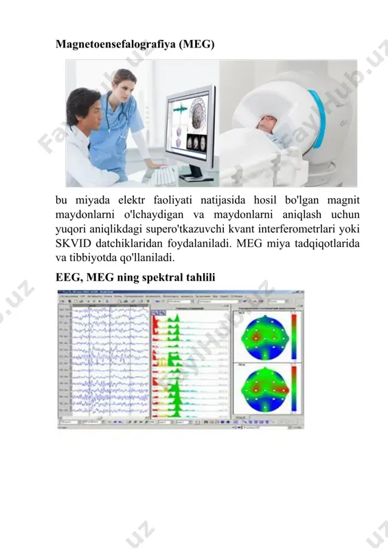 elektrokardiografiya - Page 5