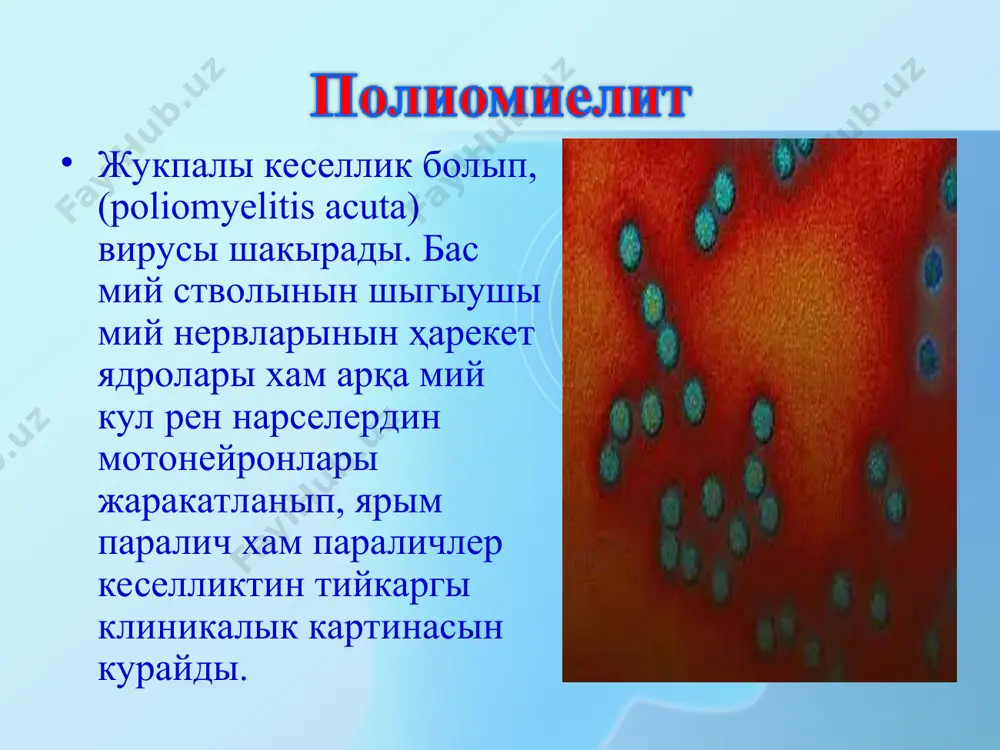 угыу итималлыгы жок емес. полиомиелит кеселлиги ыклым шараяты хар турли болган мамлекетлерде ушырасады, кобирек жаз хам гуз маусиминде ушырасады. полиомиелит кеселлигине хамме жастагы адамлар берилиушен болады, бирак кобирек 7 жаска шекемги болган балалар арасында ушырасады. кеселликтен сон организмде тураклы гуморал иммунитет пайда болады, қайта кеселлениу жагдайлары кем ушырасады. вирустын организмге дем алыу жоллары хам асказан-ишек аркалы кириуи. жуткыннын арка дийуалында хам ишек лимфа туйинлеринде вирустын кобейиуи. вирусемия (кан арқалы вирус лимфа туйинлери, бауыр, талақ, окпе, тери, журек булшык етине барыуы). вирустин нерв системасына кириуи хам оны жаракатлауы. клеткалар аралык бослыклар нерв системасы ишинде вирустын тарқалыуы. нерв клеткаларынын вируска қарсы жууабы: вирустын нерв клеткаларында максимал кобейген дауирде пайда болыуы. организмде токыма иммунитеттин ислеп шыгарылыуы. инкубацион дауир 5 куннен 30 кунге шекем болып, орташа 7-12 кун, инфекцион процесс баскышлы болганлыгы ушын откир поломиелит хар турли клиникалык формаларда кешеди. клиник формалары кеселлик дауирлери женил, ауырлык бойынша типик атипик нерв системасы жаракатланыуы бойынша 1. …