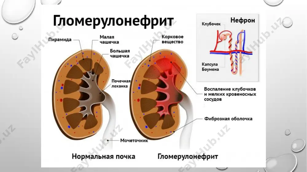 glomerulonefrit - Page 5