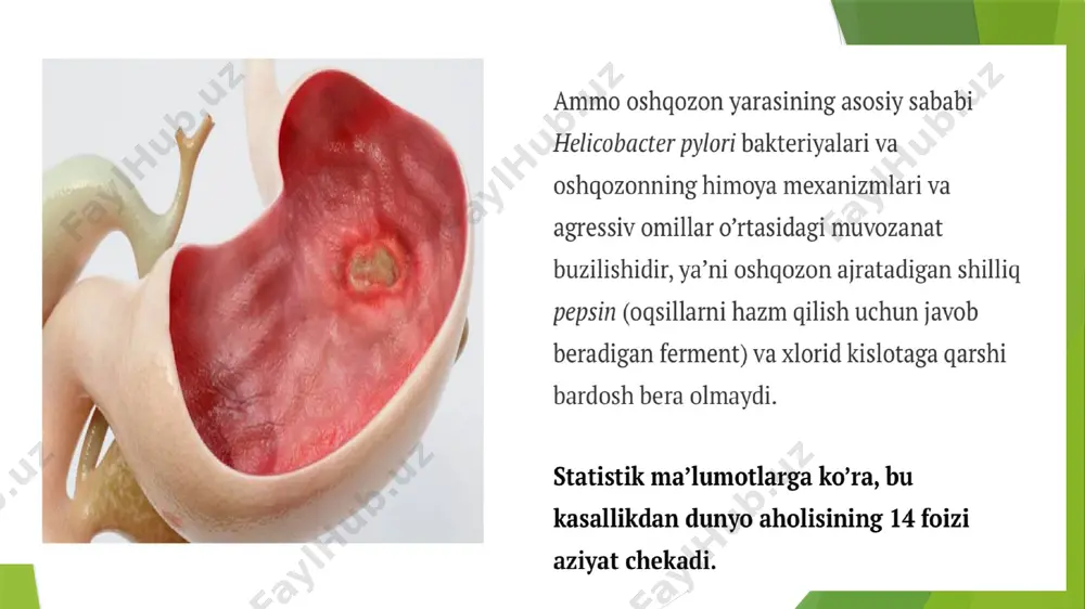 oshqozon yara - Page 3