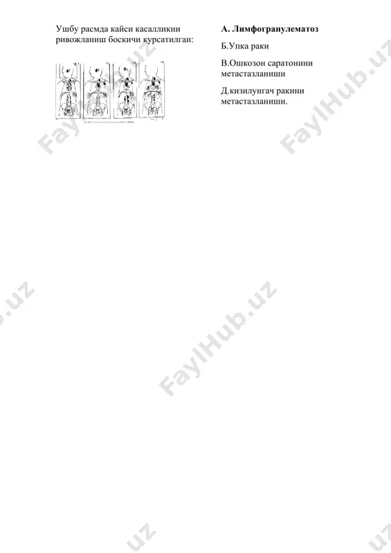 disfagiya va melanoma - Page 5