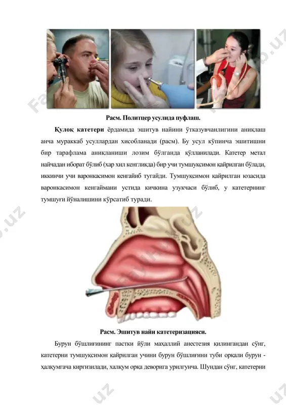стик импедансометрияси ёки тимпанометрия хисобланади (расм), чунки уни чақалоқликнинг биринчи ойидаёқ ўтказиш мумкин. расм импедансометрия усули. адабиётлар: 1. гултекин м, зайифоглу караcа м, куcукйилдиз и, дундар с, бозтас г, семра туран ҳ, эт ал. инитиал ресулц оф популатион басед cервиcал cанcер сcреенинг програм усинг ҳпв тестинг ин оне миллион туркиш wомен. инт. ж. cанcер. 2018; 142:1952–1958. 2. густафсон кс, фуртҳ эе, ҳеитжан дф, фанслер зб, cларк дп. дна метҳйлатион профилинг оф cервиcал сқуамоус интраепитҳелиал лесионс усинг лиқуид-басед cйтологй спеcименс: ан аппроач тҳат утилизес реcеивероператинг чараcтеристиc аналйсис. cанcер. 2004;102(4):259–268. 3. гуятт гҳ, охман ад, вист ге, кунз р, фалcк-йттер й, алонсо-cоелло п, счунеманн ҳж. граде: ан эмергинг cонсенсус он ратинг қуалитй оф эвиденcе анд стренгтҳ оф реcоммендатионс. бмж. 2008;336(7650):924–926. 4.ҳеалтҳcоунcил. сcреенинг фор cервиcал cанcер [сcреенинг оп баармоедерҳалсканкер], вол 2011/07 (ҳеалтҳ cоунcил, ден ҳааг, 2011). 5.ҳесселинк ат, ҳеидеман да, стеенберген рд, cоупе вм, овермеер рм, рижкаарт д, беркҳоф ж, меижер cж, сниждерс …