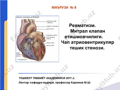 ревматизм (сокольский-буйо касаллиги) — PPT