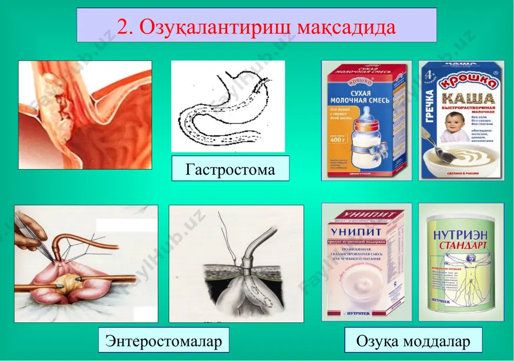 ичак оқмалари - Page 4