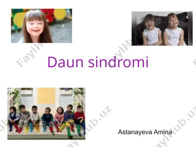daun sindromi — PPTX