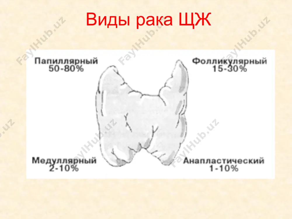 не прорастают в капсулу. на той стороне шеи, где расположен рак, могут быть метастазы. iii стадия. опухоль прорастает в капсулу щитовидной железы. она сдавливает трахею и окружающие ткани, спаивается с ними. появляются метастазы в шейные лимфатические узлы по обе стороны от железы. iv стадия. опухоль глубоко прорастает в окружающие ткани, щитовидная железа становится неподвижной и сильно увеличивается в размерах. обнаруживаются метастазы в ближних и отдаленных органах. операция при раке щитовидной железы показанием к проведению операции является подозрение на рак. если биопсия подтвердила, что в узле щитовидной железы есть раковые клетки, то его однозначно нужно удалять. если опухоль очень маленькая, то врач предложит удалить половину щитовидной железы с перешейком. эта операция называется гемитиреоидэктомия. оставшаяся доля берет на себя выработку гормонов. но большинство врачей считает, что лучшим вариантом будет полное удаление щитовидной железы - тиреоидэктомия. только в этом случае можно быть уверенным, что не пропущена никакая, даже самая маленькая, опухоль и рак …