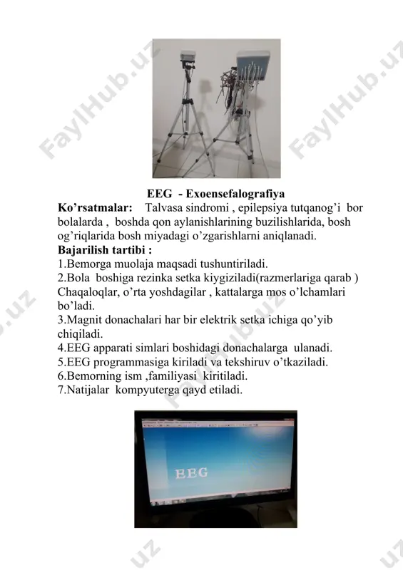 torda kuzatiladi va tasvirga tushirilib, xulosa qaydlar orqali chiqariladi. eslatma: mskt-multispiral kompyuter tomografiyaning qismlari: asosiy gentr(miya-rasmga olib beradi), stol uskuna, xotira saqlovchi komponentlar , pult qismidan iborat. apparat rentgen nurlari asosida ishlaydi. barcha kasalliklarda shifokor-travmatolog ko’rsatmasi bilan tekshiruv amalga oshiriladi. ups (united power system) –tokni moslashtirib beruvchi qismi. tokni quvvatini ushlab turadi, bemorni tok bo’lmagan paytda bemorni olib chiqish uchun qo’llaniladi. shu bilan birgalikda apparatni kuyishdan saqlab beradi. tekshiruv amalga oshirilganda bosh sohasida quyidagi ko’rinishdagi suratlar olinadi: alteych-raqamli apparat. rentgen flyurografiya kabinetida foydalaniladi. qo’llanilishi : -travmadan keyingi holatda siniq alomatlarini belgilash; -bo’g’imlardagi tuzlarni aniqlash; -o’pkadagi pnevmoniya holatlarini aniqlash; -organizmga yot jismlar kirganda birlamchi aniqlash. alteych-raqamli apparatda qo’lda o’tkazilgan tekshiruvda quyidagi natijalar olinadi: exo - exokardiogramma (yurak dopler apparati). maqsad: apparat yurak qon tomir kasalliklarini aniqlashda qo’llaniladi. apparat yurak qon tomir tizimi kasalliklarini aniqlashda qo’llaniladi. bajarilish tartibi: 1.bemorga muolaja maqsadi tushuntiriladi. 2. qo’llar yuvilib, quritiladi. 3. apparat ishlash prinsipi nazorat qilinadi. …