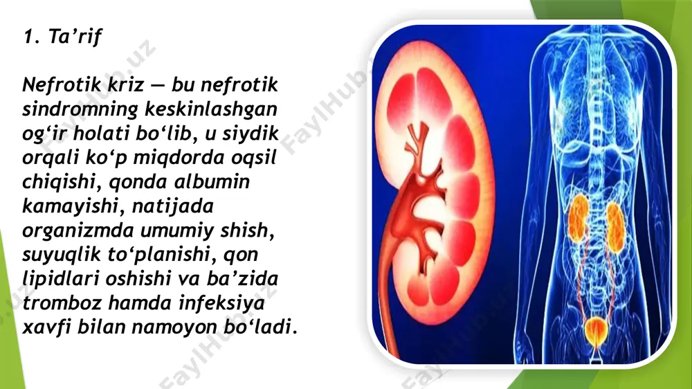 bosqich: tezkor baholash naqshli tekshiruv: nafas olish, yurak urishi, qon bosimi. shish va asit darajasini aniqlash. siydik chiqarishni kuzatish. 2-bosqich: hayotiy ko‘rsatkichlarni barqarorlashtirish kislorod berish (nafas yetishmovchiligi bo‘lsa). ehtiyotkorlik bilan vena ichiga suyuqlik yuborish (faqat gipovolemiya bo‘lsa). suyuqlik balansini hisoblash. 3-bosqich: dori terapiyasi diuretiklar (shishni kamaytirish uchun). albumin infuziyasi (qonda albumin pasayganda). kortikosteroidlar (immun jarayonni pasaytirish, proteinuriyani kamaytirish). immunosupressivlar (ayrim hollarda). antikoagulyantlar (tromboz xavfi yuqori bo‘lsa). antibiotiklar (qo‘shilgan infeksiya bo‘lsa). lipidni kamaytiruvchi dorilar (uzoq muddatli davolash). 4-bosqich: monitoring qon bosimi, puls, nafasni doimiy kuzatish. kunlik vazn va diurezni o‘lchash. qon va siydik tahlillarini qayta tekshirish. 7. uzoq muddatli yordam va profilaktika tuz va suyuqlikni cheklash (shifokor ko‘rsatmasiga ko‘ra). oqsil yetarli bo‘lgan parhez. infeksiyadan himoya (emlash, gigiyena). doimiy nefrolog nazorati. tromboz profilaktikasi. eʼtiboringiz uchun rahmat image1.jpeg image2.jpeg image3.jpeg /docprops/thumbnail.jpeg