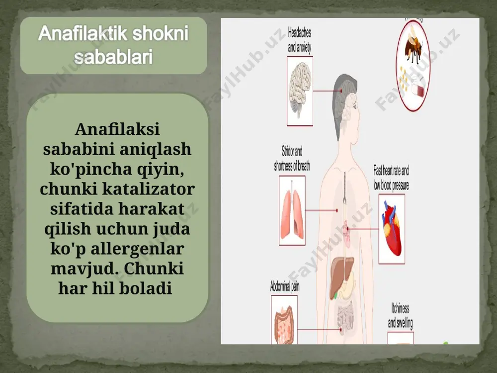 anafilaktik shok - Page 3