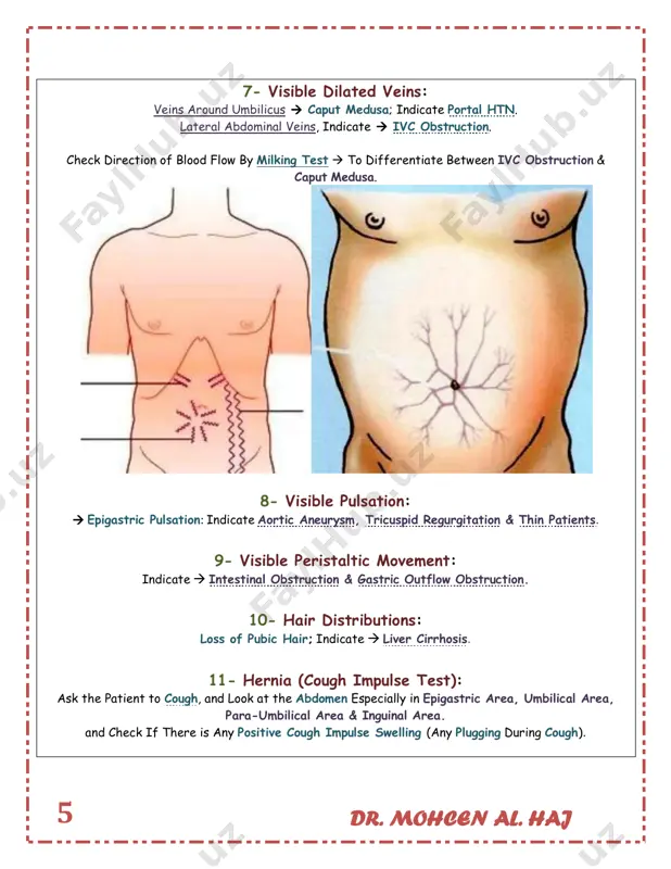 nd measure liver span between upper border of liver & lower border of liver, (normally between 8 – 12 cm). dr. mohcen al. haj 10 if you detect liver enlarged; you have to comment on: tenderness, surface, edge & consistency. if you didn’t palpate the liver; do percussion but only for upper border of liver. differential diagnosis of hepatomegaly: 1. heart failure. 2. early liver cirrhosis. 3. malignancy: primary or secondary metastasis, leukemia. 4. infection: hepatitis, hydatid cyst. dr. mohcen al. haj 11 2. spleen spleen will be palpable if it is 3 times more enlarged than normal. massive splenomegaly is more than 8 cm below costal margin. 1. right hand placed in right iliac fossa. 2. ask the patient to take slow deep breathing from his mouth. 3. palpate deeply in upward direction by tip of the fingers toward right hypochondrium cross above umbilicus. 4. put your left hand …