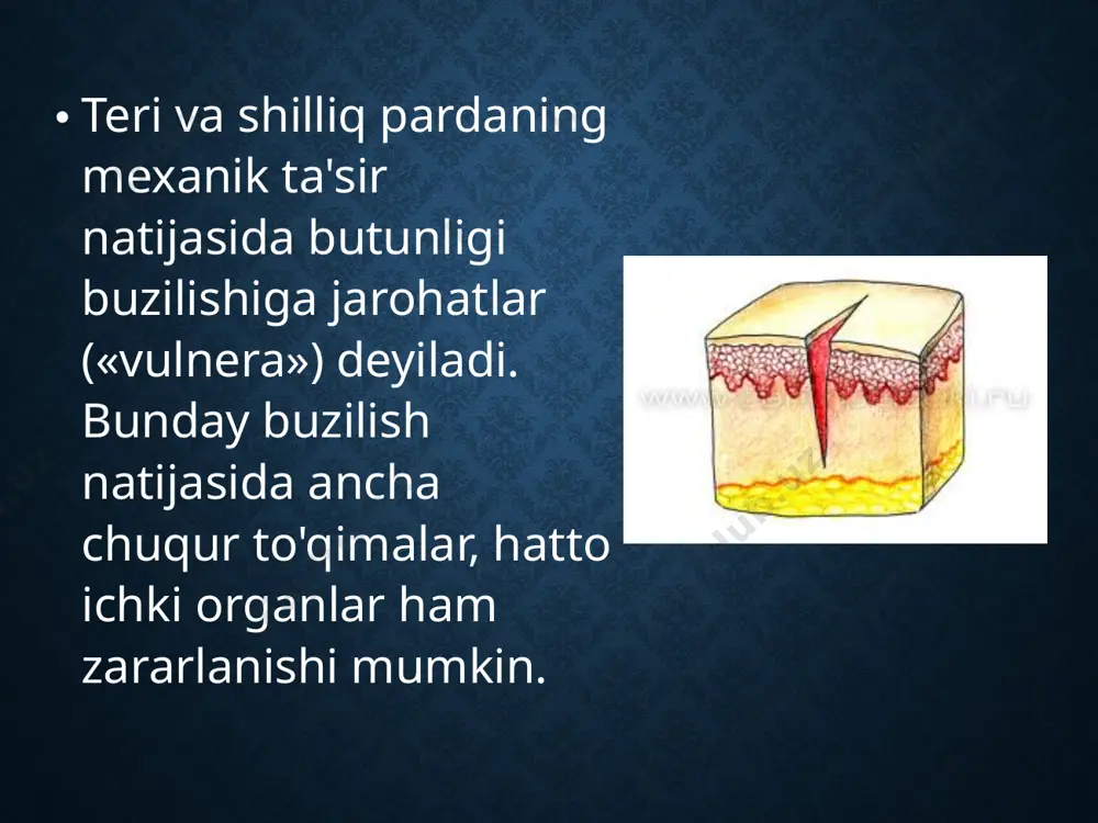 hda hisobga olish kerak. masalan, sanchilgan, o'q tekkan jarohatlar ko'pincha kam qonaydi. ko'z bilan ularning chuqurligini aniqlash qiyin, ko'pincha ichki organlar shikasti bilan farqlanadi. o'tmas ashyolar, zont uchi, metall uchliklardan hosil bo'lgan sanchilgan jarohatlar kechishi boshqacha bo'ladi. kesilgan va chopilgan jarohatlar tashqi nuqsonlar kengligi, ko'p tashqi qon ketishi bilan xarakterlanadi. unlgan, ezilgan va yirtilgan jarohatlarda qon kam ketsa-da, ular kuchli og'riq beradi, ifloslanadi, ko'pincha ular to'qimalar mahalliy nekrozi, qon aylanishi buzilishi bilan kechadi. yengil urilish (lat yeyish) og'riq bilan kechsada, og'ir oqibatlarga olib kelmaydi. tishlangan jarohatlar faqat o'zining kattaligi, chuqurligi, yiringlashi bilan farqlansa-da, og'ir asoratga - quturish kasalligiga («lussa, rabies») olib keladi. quturish virusi quturgan hayvon so'lagi bilan u tishlab olganda jarohatga o'tadi. kalamush, sichqon, olmaxon va mushuklar tishlaganda «kalamush kasalligi» («sodoku») paydo bo'lishi mumkin. kesilgan jarohatlar o'tkir narsa (qurol) tekkanda yuz beradi, odatda atrofdagi to'qimalar zararlanmaydi. jarohat chetlarining bir-biridan ajralib turishi, to'g'riligi, jarohat uchlari esa o'tkir bo'lishi bilan farqlanadi. …
