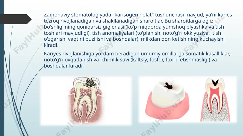hajmli bo’lgani uchun nooperativ davo usullari yordam bermaydi. o`rta kariesda karioz bo`shlig’ini charxlash uslubi shartlidir. charxlash va plombalash quyidagi ketma ketlikda bajariladi: og’riqsizlantirish, karioz bo`shlig’ini ochish va kengaytirish, emal qirralariga finir bilan ishlov berish, dori darmonlar bilan ishlov berish, ajratuvchi taglik hamda doimiy plomba qo`yish va plombaga yakuniy ishlov berish o'rta kariesni operativ davolash o’rta kariyesni charxlash bosqichlari karies bo`shlig’ini ochish dentin to`qimasida tayanch nuqtasi bo`lmagan, osilib turgan emal qirralarini olib tashlashdan iborat. bunday emal qirralarini kesish maqsadida qattiq bo`lmagan sharsimon yoki fissurali borlar ishlatiladi. karies bo`shlig’ini kengaytirish. karies kasalligi jarayonini tarqalishini oldini olish, hamda karies kovagi tubini ko`rish va unga ishlov berish maqsadida yumshagan dentin to`qimasi devorlardan olinadi. asosan hajmi katta bo`lgan silindrsimon, konussimon borlar ishlatiladi. nekroektomiya, bu jarayonda yumshagan dentin va pigmentlangan emal va dentin to`qimasi sog’lom to`qimasigacha to`liq olinadi. bu muolaja fissur va sharsimon borda bajarilsa maqsadga muvofiq bo`ladi, qattiqlashgan pigmentli dentin to`qimasi esa sharsimon borda olinadi. …