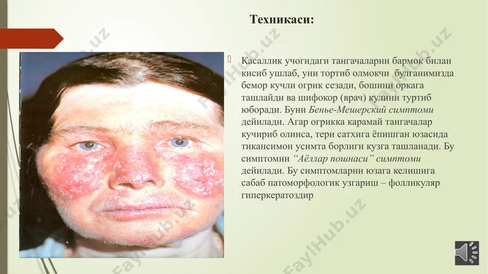 dermatovenereologiya kafedrasi - Page 3