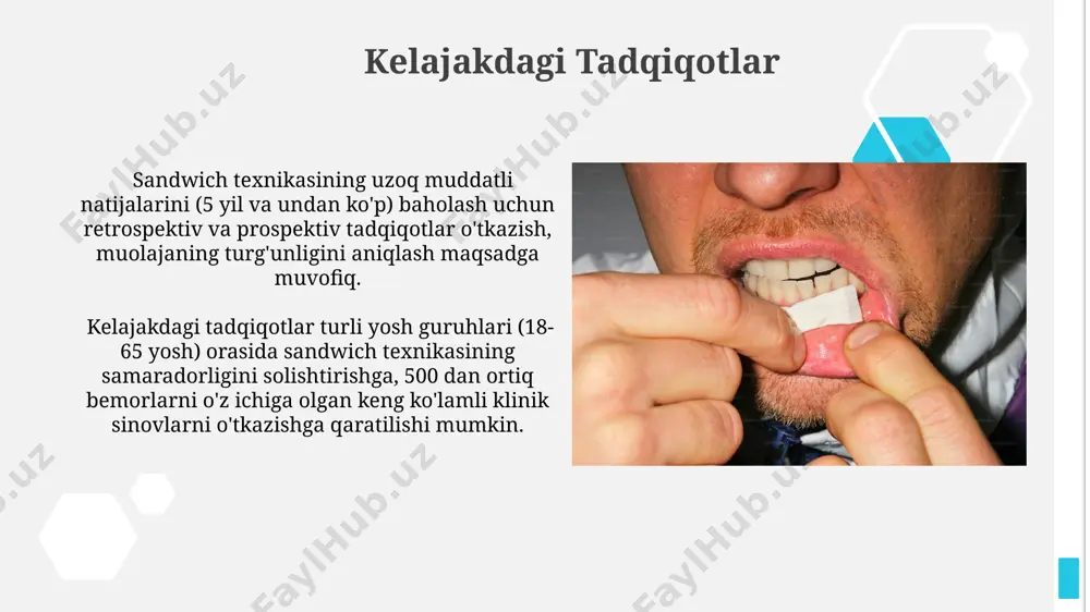 stomatologiyada sandvich usulida plombalash - Page 3