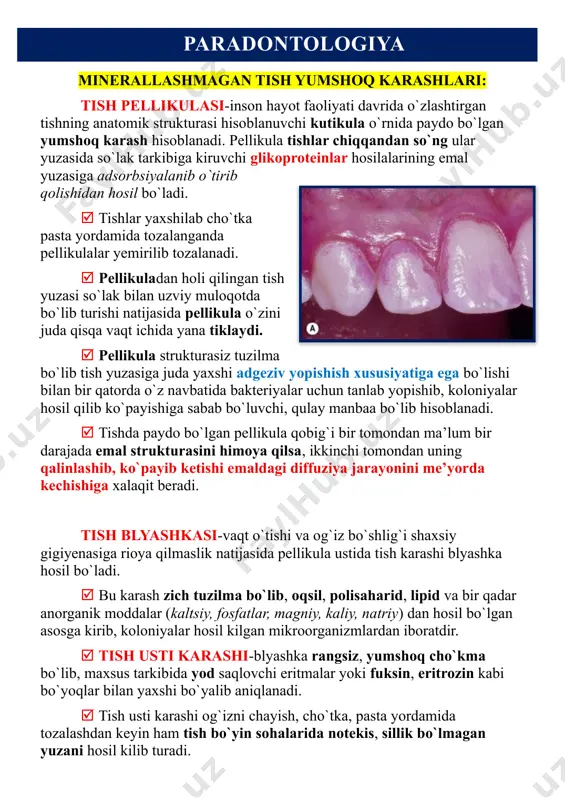 shil yumshoq karashlarning hosil bo`lishi xlorofill saqlovchi xromogen mikroorganizmlarning hayoti faoliyati bilan bog`liqdir. yumshoq, jigarrang tish karashi asosan chekuvchilarda uchraydi. uning rangini to`q yoki ochligi nikotin va ko`p, oz chekishga bog`liqdir. bu xil karashlar tish cho`tka va pastasi yordamida qiyinchilik bilan tozalanadi. jigarrang tish karashlari chekmaydiganlar og`iz bo`shlig`ida misli amalgama plombalari mavjud insonlarda va bronzadan, latun, misdan yasaladigan mahsulotlar tayyorlovchi kishilarda ham uchraydi . paradontologiya ovqat qoldiqlari - tishlar qatorida mavjud bo`lgan retensiya sohalarida tiqilib qoladi. ular lablar, lunjlar, tilning harakati va og`iz chayish paytida oson ko`chib tushib ketadi. yopishqoq uglevodli ovqatlar, shirinliklar qabulidan keyin ularning bir qismi tishlarning retensiya nuqtalarida o`rnashib qolib, achish va chirish jarayonini ta’minlab turadi. mikroorganizmlar uglevodli ovqatlarni bijg`itish yo`li bilan sut kislotasi hosil qiladi, bu esa o`z navbatida tish emaliga ta’sir qilib demineralizatsiya jarayonini boshlanishiga sabab bo`ladi. paradontologiya minerallashgan tish toshlari milk usti toshlari - milk qirrasi ustida joylashgan bo`lib, oson aniqlanadi. milk usti toshlari …