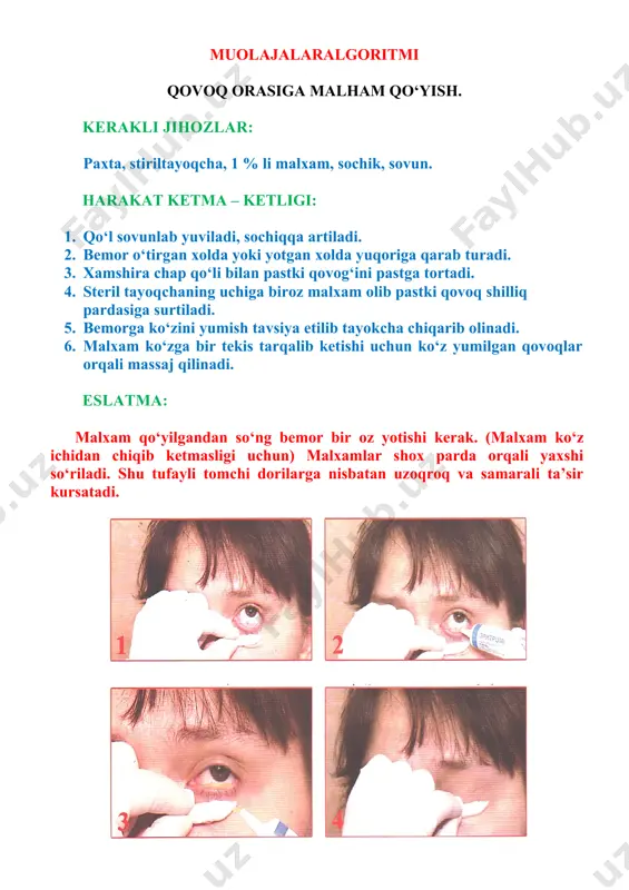 qni tortadi. 4. bemor yuqoriga qarab turadi. 5. xamshira qo‘lining bosh va ko‘rsatkich barmoklari bilan tomizgich yordamida kon’yuktivaning pastki gumbaziga 1 – 2 tomchi dori tomizadi. 6. ko‘z yumilganda qovoq chetlaridan oqib chiqadigan ortikcha dori paxta tampon bilan artib olinadi. eslatma: ko‘zga 2 tomchidan ortik suyuqlik sig‘maydi. tomiziladigan dorilar uy temperaturasida bo‘lishi lozim. tomizgichning uchi bemor kipriklariga tegmasligi kerak. (eritma ifloslanmasligi uchun) dorilar 2 sm masofada tomiziladi. (2 sm masofadan balandlikda tomizilsa, tomchi zarb bilan kelib tushadi, 2 smdan pastrokdan tomizilsa shikastlabko‘yish mumkin). muolajalaralgoritmi qovoq va qovoq qirralarini ko‘zdan kechirish. kerakli jihozlar: sharchalar. harakat ketma – ketligi: 1. pastki qovoqni ag‘darish uchun uni pastga tortish va orbitaning suyak qirrasiga astagina bosib turish kerak, bu vaqtda bemor yuqoriga qarab turishi lozim. 2. ustki qovoq shilliq pardasini ko‘zdan kechirishda bemor pastga qarab turishi kerak. 3. tekshiruvchi bir qo‘l kaftini bemor peshonasiga qo‘yadi va bosh barmog‘i bilan ustki qovoqni yuqoriga tortadi. 4. ikkinchi …