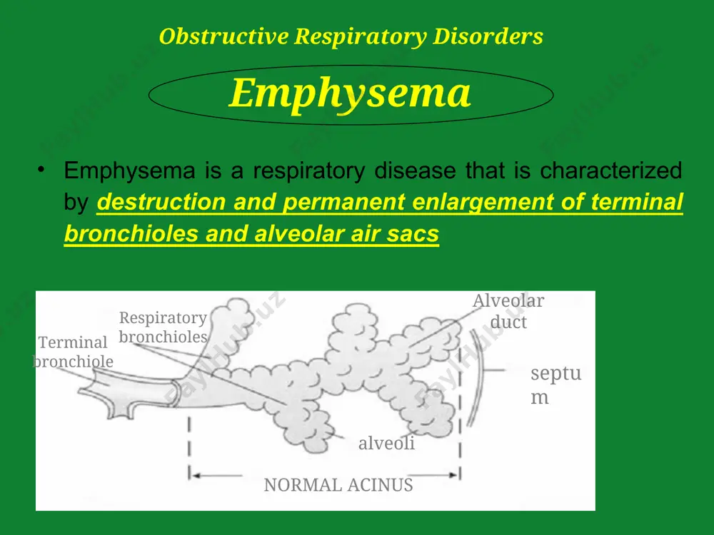 respiratory diseases - Page 4