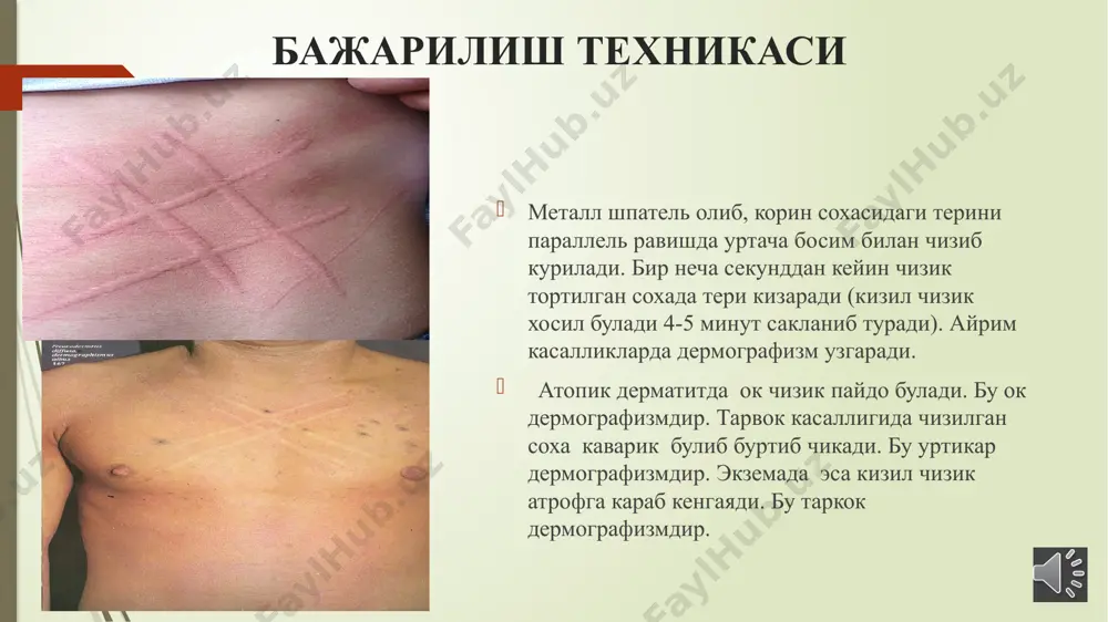 dermografizmni aniklash uchun uslubiy o'qilma - Page 3