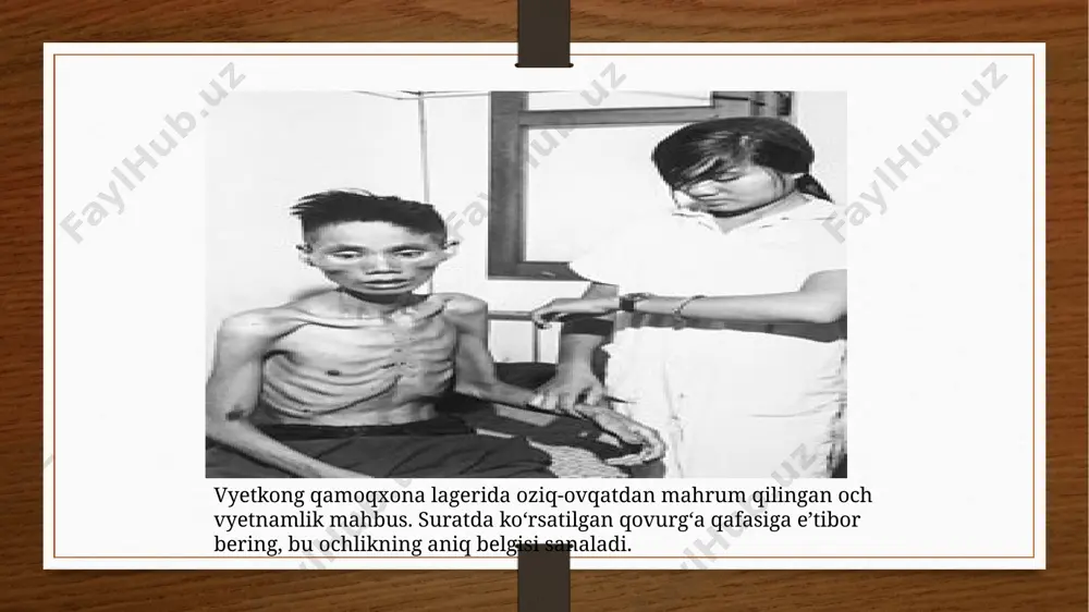 onlardan foydalanish glyukozaga boʻlgan ehtiyojni kamaytiradi va organizm oqsil parchalanishini sekinlashtiradi. sabablari vyetkong qamoqxona lagerida oziq-ovqatdan mahrum qilingan och vyetnamlik mahbus. suratda koʻrsatilgan qovurgʻa qafasiga eʼtibor bering, bu ochlikning aniq belgisi sanaladi. tana qabul qilganidan koʻra koʻproq energiya sarflaydi. ushbu nomutanosiblik bir yoki bir nechta tibbiy holatlar yoki shartli vaziyatlar natijasida kelib chiqishi mumkin, jumladan:[18] tibbiy sabablari anoreksiya nervozi; bulimiya nervozi; ovqatlanish tartibining buzilishi; ovqat hazm qilish tizimining buzilishi; koma; katta depressiv buzilish; qandli diabet; doimiy qusish. shartli sabablari ochlikning oldini olish ochlik insonning nazorati ostida boʻlmagan omillar tufayli yuzaga kelishi mumkin. jahon oziq-ovqat xavfsizligi bo'yicha rim deklaratsiyasi oziq-ovqat xavfsizligini oshirishga va natijada ochlikning oldini olishga qaratilgan bir qancha siyosat yoʻnalishlarini belgilaydi[. ushbu yoʻnalishlar quyidagilardir: qashshoqlikni kamaytirish; urushlar va siyosiy beqarorlikning oldini olish; oziq-ovqat yordami; qishloq xoʻjaligining barqarorligi; iqtisodiy tengsizlikni kamaytirish. bepul yoki subsidiya asosida beriluvchi oʻgʻitlar va urugʻlardan foydalanish kabi chora-tadbirlar orqali oziq-ovqat xavfsizligi taʼminlanmagan hududlarda fermerlarni qoʻllab-quvvatlash oziq-ovqat …