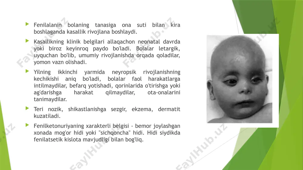 lishi mumkin. tug'ilganda pigment butunlay yo'q. tirazinaza faolligi mavjud bo'lganligi sababli , ba'zi odamlarda soch, teri va ko'zlarning pigmentatsiyasi yoshga qarab kuchayishi mumkin va teri quyoshdan sarg'ayishni boshlaydi. ocl albinizm 2 bu barcha irqlarda albinizmning eng keng tarqalgan turi. ushbu kasallik ham autosomal retsessivdir, ammo boshqa xromosomada lokalizatsiya qilinadi. bunday holda, p-oqsilni kodlovchi gen ta'sir qiladi va tirozinaza sintezi normal bo'lib qoladi. ocl albinizm 3 afrikalik bemorlarda klinik fenotip ochiq jigarrang yoki sarg'ish teri va sochlar, jigarrang-ko'k irislardir. optik nervlarning ishidagi buzilishlar sezilmadi. davolash bugungi kunga qadar albinizm uchun maxsus davolash mavjud emas, faqat bemorning hayot sifatini yaxshilash uchun profilaktika choralari ishlab chiqilgan. mavjud ko'rish darajasini saqlab qolish uchun ko'zlarni quyosh nurlaridan himoya qilish kerak - bu maxsus quyoshdan saqlaydigan ko'zoynak yoki kontakt linzalarini kiyish orqali erishiladi. yorqin quyoshga ta'sir qilishdan qochish yoki terini maxsus kremlar va losonlar bilan himoya qilish kerak. agar siz ushbu tavsiyalarga amal qilsangiz, umuman olganda, …