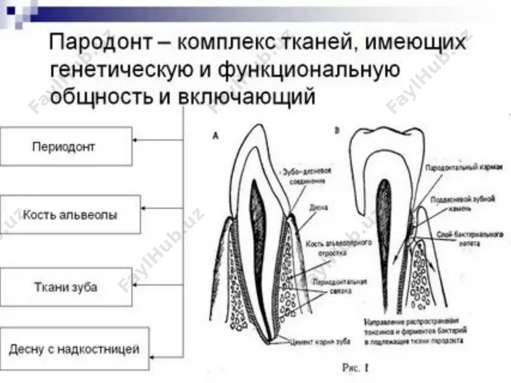 рогрессирующим лизисом тканей пародонта (синдром папийона-лефевра, гистиоцитоз х, нейтропения и др.). v. пародонтомы - опухоли и опухолевидные процессы в пародонте (эпулис, фиброматоз десны и др.). * классификация болезней пародонта по мкб-10: к05 гингивит и болезни пародонта; k05.0 острый гингивит k05.1 хронический гингивит: - к05.10 простой маргинальный; - к05.11 гиперпластический; - к05.12 язвенный. k05.2 острый пародонтит, пародонтальный абсцесс; k05.3 хронический пародонтит: - к05.30 локализованный; - к05.31 генерализованный. k05.4 пародонтоз; k05.5 другие болезни пародонта; k05.6 болезнь пародонта неуточненная. * гингивит гингивит – выявляется преимущественно у детей и лиц молодого возраста; – наличие неминерализованных зубных отложений и наддесневого зубного камня; – прямая зависимость между показателями индекса гигиены и гингивита; – сочетание гингивита с очаговой деминерализацией; – кровоточивость при зондировании десны, отсутствие десневого кармана; – отсутствие деструкции межзубных перегородок; – общее состояние больного не нарушено. тяжесть гингивита определяется степенью вовлечения десны в патологический процесс. при легкой степени наблюдается поражение десневых сосочков, при средней степени …