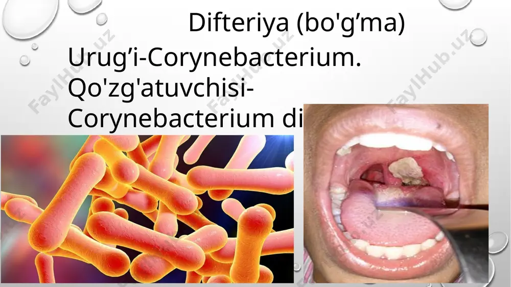 tashkil topgan. - difteriya tayoqchalari gialuronidaza, neyraminidaza, fibrinolizin fermentlarini ham hosil qiladi, bular bakteriyaning toksigenligini yanada oshirib, to'qimalar orasida tarqalishini ta'minlaydi. - difteriya ekzotoksini fizik va kimyoviy omillar ta'siriga chidamsiz, shuning uchun temperatura, yorug'lik, kislorod ta'sirida parchalanadi. chidamliligi. - difteriya korinebakteriyalari tashqi muhit ta'siriga chidamli. - turli buyumlarda 15 kungacha, sut va suvda 6--20 kungacha, kuz va bahorda esa buyumlarda 5,5 oygacha, bemordan olingan materialda ham uzoq saqlanadi. - qaynatilganda bir daqiqada, 60°c haroratda qizdirilganda 10 daqiqada o'ladi. dezinfeksiyalovchi moddalarcritmalari ularni bir necha daqiqada o'ldiradi. kasallikning odamlardagi patogenezi. - kasallik, asosan, havo- tomchi va chang orqali yuqadi, ammo turli o'yinchoq, idish-tovoq, kitob va boshqa buyumlar, shuningdek, difteriya qo'zg'atuvchisi tushgan oziq- ovqatlar orqali ham yuqishi mumkin. - difteriya korinebakteriyasining kirgan joyida (tomoq, ko'z, traxeya, quloq, burun, teri, jinsiy a'zolar va boshqalar) mahalliy yallig'lanish rivojlanib parda hosil bo'ladi. immuniteti. difteriyadan so'ng antitoksik immunitet paydo bo'ladi, ammou kuchli emas, shuning uchun 6-7% bolalar …