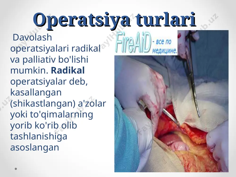 muqarrar tushishi); 4) iflos yoki birlamchi kasallik yuqtiruvchi operatsiyalar. bemorni ruhan tayyorlash . xirurgik operatsiya ruhiy jihatdan sog'lom kishilarda u yoki bu darajada ruhan ezilishiga sabab bo'ladi. buni bartaraf etish yoki kamaytirishning uddasidan chiqilsa, bemorni operatsiyaga tayyorlashga ham, operatsiyadan keyingi natijalarga ham yaxshi ta'sir ko'rsatadi xirurgik operatsiyani o'tkazish jarrohlik yo'li bilan davolashni to'g'ri amalga oshirish uchuk katta ahamiyatga ega bo'lgan operatsiya xonasidagi ishlarni tashkil etish haqida ham gap boradi xirurgik operatsiya bir nechta bosqichdan iborat: 1) bemorni operatsiya stoliga yotqizish; 2) operatsiya maydonini tayyorlash; 3) og'riqsizlantirish; 4) operatsiya qilishga kirishish; 5) operatsiyani amalga oshirish 6) operatsiyani tugatish. bemorni operatsiya stoliga yotqizish hamma narsa operatsiyaga layyorlangan, operatsiya stoli ustiga kleyonka va toza choyshab yozilgandan so'nggina bemor operatsiya xonasiga olib kiriladi operatsiyada qo’llaniladigan asboblar skalper turlari va uni ushlash yonboshlab yotish holati buyrak yoki ko'krak qafasida operatsiya amalga oshirilganda qo'llaniladi. ginekologik holatdan to'g'ri ichak, prostata bezi, tashqi jinsiy a'zolar va qin operatsiya …
