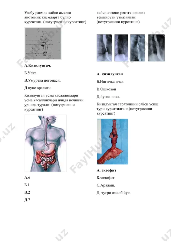ulematoz b.upka raki v.oshkozon saratonini metastazlanishi d.kizilungach rakini metastazlanishi.