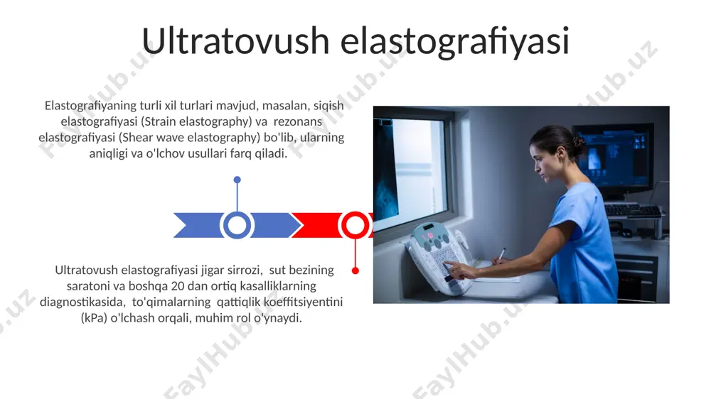 a biopsiya zaruratini kamaytiradi va 15-20% hollarda operativ aralashuvdan qochishga yordam beradi. elastografiyaning klinik qo'llanilishi stivlikni o'lchash usullari qattiqlikni o'lchashning bir usuli - bu elastik to'qimalarning deformatsiyasi darajasini aniqlash uchun ultrasound to'lqinlarining tezligini o'lchash orqali amalga oshiriladigan tezlik elastikografiyasi bo'lib, bu 1-5 khz diapazonida bo'lishi mumkin. rezonans mexanik spektroskopiyasi (rms) esa turli chastotalardagi tebranishlarga to'qimaning javobini o'lchab, ko'p sonli (odatda 10 dan ortiq) parametrlarni hisoblab chiqib, to'qimaning mexanik xususiyatlarini aniqlaydi. qattiqlikni tasvirlash texnologiyalari strain elastografiyasi to'qima deformatsiyasini o'lchash orqali, masalan, 2-5 mm gacha bo'lgan siqilishni aniqlaydi va bu ma'lumotlarni rangli kodlash orqali patologik hududlarni aniqlashga yordam beradi. stress elastografiyasi esa doimiy bosim ostida to'qimalarning qattiqligini o'lchaydi va bu ko'rsatkichlarni 1 dan 10 gacha bo'lgan shkala bo'yicha tasvirlaydi, bu esa shifokorga diagnostika qo'yishda yordam beradi. qalqonsimon bez kasalliklarida elastografiya қалқонсимон безининг тугунларидаги эластикликнинг ўзгариши, яъни қаттиқлик даражаси (эластик модули) 2-5 кпа бўлган тугунлар хавфли бўлиши эҳтимоли юқори. эластография текшируви натижаларининг ташхис …