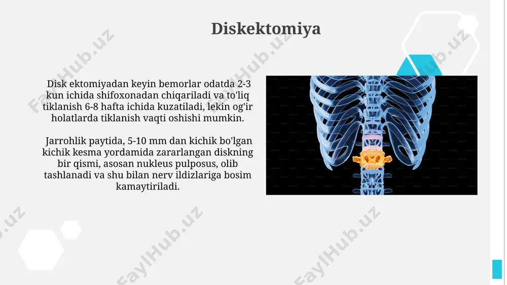 g orqa yuzasidagi lamina suyaklarini olib tashlashni o'z ichiga oladi va shu bilan nerv ildizlarini siqilishidan ozod qiladi. ushbu operatsiya davomida taxminan 2-3 soat davom etadi va bemorga umurtqa pog'onasidagi og'riq, parestez, yoki falaj kabi muammolarga qarshi samarali yordam beradi. operatsiyadan keyin tiklanish davri esa individualdir. orqa miya jarrohligi haqida umumiy ma'lumot orqa miya jarrohligi, murakkab jarrohlik amaliyotlari bo'lib, taxminan 100 dan ortiq turdagi operatsiyalarni o'z ichiga oladi va bemorning umurtqa pog'onasining shikastlanish darajasi va turiga bog'liq holda amalga oshiriladi. laminectomiya kabi keng tarqalgan usullar suyak bo'laklarini olib tashlashni va nervlarga bosimni kamaytirishni o'z ichiga oladi, ba'zi operatsiyalar esa mikroskop yordamida amalga oshiriladi va yuqori aniqlikni ta'minlaydi. orqa miya jarrohligiga ko'rsatmalar orqa miya o'smalari, ya'ni 2 sm dan katta hajmdagi benign yoki malign neoplazmalar, jarrohlik aralashuvining asosiy ko'rsatmalaridan biri hisoblanadi. jarrohlik amaliyoti o'smaning o'sishini to'xtatish va nerv tuzilmalariga bosimni kamaytirish uchun o'tkaziladi. orqa miya jarrohligiga og'ir travmatik shikastlanishlar, masalan, 5 …