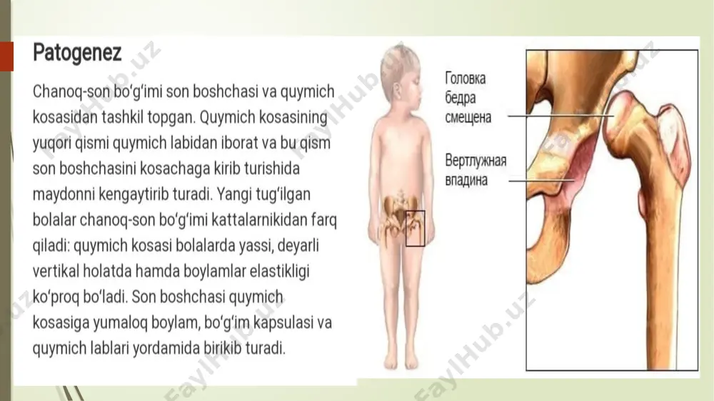 chanozq-son bo’g’imi displaziyasi - Page 3
