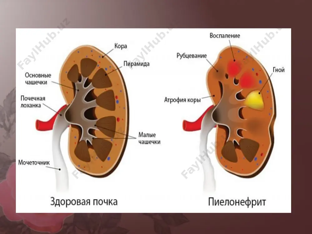qilish talab qilinadi. agar kerak bo’lsa immunitetni mustahkamlash uchun immunostimulyator va immunomodulatorlardan foydalaniladi. remissiyaga erishilgach, bemorga uzilishlar bilan antibakterial terapiya kurslari beriladi. remissiya davrida surunkali pielonefritli bemorlarga sanatoriyalarda davolanish tavsiya etiladi. terapiyaning majburiy davomiyligini esdan chiqarmaslik kerak. shifoxonada boshlangan antibakterial davo ambulatoriya sharoitida davom ettirilishi kerak. qo’shimcha davolash usuli sifatida fitoterapiya qo’llaniladi. image2.jpeg image3.jpg image4.jpg image5.jpg image6.jpg image7.jpg image8.jpg image9.jpg image10.png image11.jpg image12.jpg image1.jpeg /docprops/thumbnail.jpeg