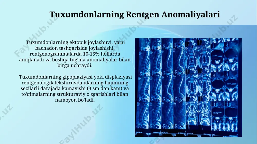 hazm azolarining rentgenanatomiyasi va rivojlanish nuqsonlari - Page 4