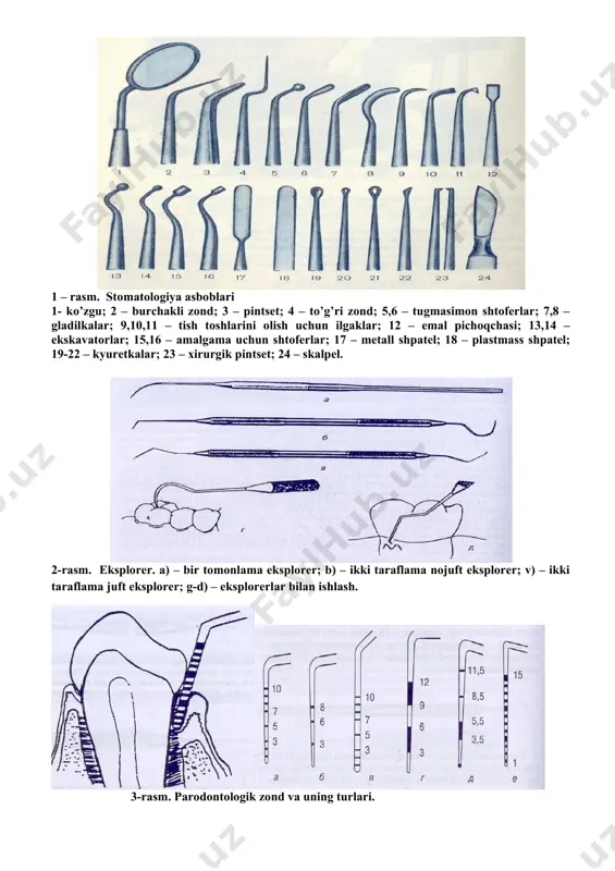 4. tish toshlarini olish uchun 5. endodontik asboblar 1 – rasm. stomatologiya asboblari 1- ko’zgu; 2 – burchakli zond; 3 – pintset; 4 – to’g’ri zond; 5,6 – tugmasimon shtoferlar; 7,8 – gladilkalar; 9,10,11 – tish toshlarini olish uchun ilgaklar; 12 – emal pichoqchasi; 13,14 – ekskavatorlar; 15,16 – amalgama uchun shtoferlar; 17 – metall shpatel; 18 – plastmass shpatel; 19-22 – kyuretkalar; 23 – xirurgik pintset; 24 – skalpel. 2-rasm. eksplorer. a) – bir tomonlama eksplorer; b) – ikki taraflama nojuft eksplorer; v) – ikki taraflama juft eksplorer; g-d) – eksplorerlar bilan ishlash. 3-rasm. parodontologik zond va uning turlari. ortopediya so’zi ikkita grekcha so’z o’zagidan iborat bo’lib, orthos — to’g’ri va paideuo — tarbiyalamoq yaratmoq degan ma’nolarni anglatadi. ilgarilari ortopediya deganda tibbiyotning bolalarning odatdan tashqari qiyshiq o’sadigan oyoq-qo’llari va umurtqalarini davolash bilan shug’ullanuvchi bo’limi tushunilar edi. ortopedik stomatologiya umumiy ortopediyaning bir bo’limi bo’lib, stomatologiyaning esa ancha keng, murakkab va …